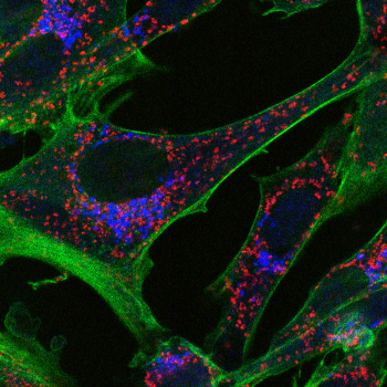 Bunyavirus Factory Confocal Microscopy